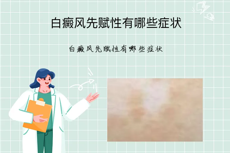白癜风先赋性有哪些症状