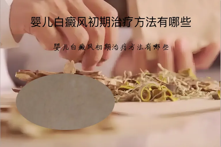 婴儿白癜风初期治疗方法有哪些