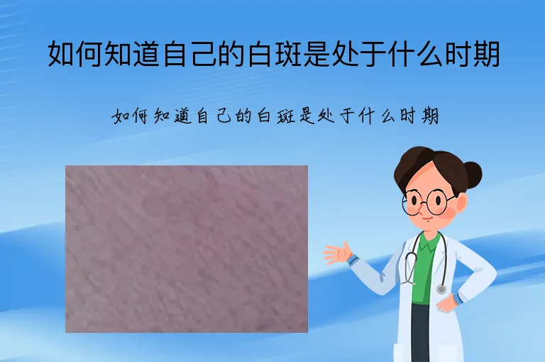 如何知道自己的白斑是处于什么时期
