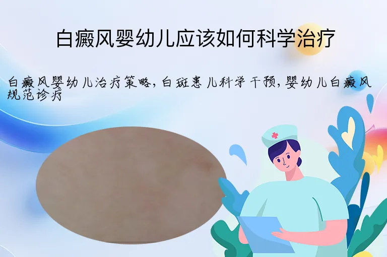 白癜风婴幼儿应该如何科学治疗