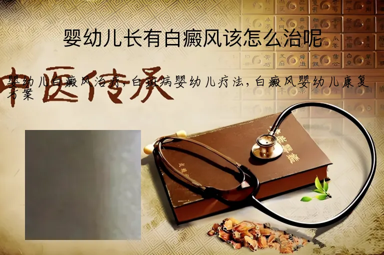 婴幼儿长有白癜风该怎么治呢