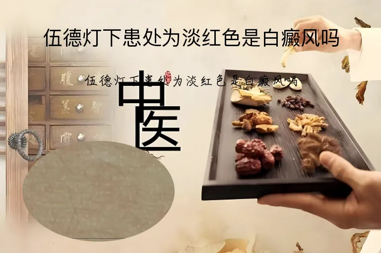 伍德灯下患处为淡红色是白癜风吗