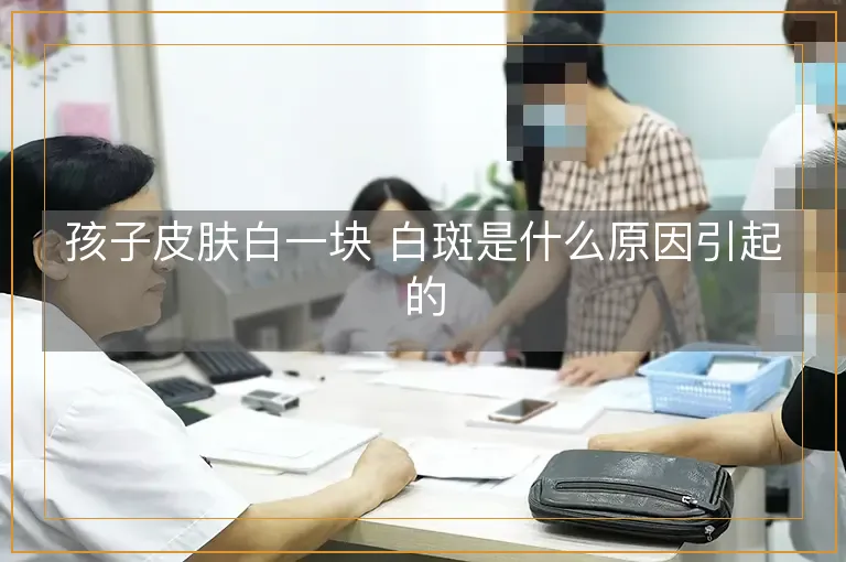 孩子皮肤白一块 白斑是什么原因引起的