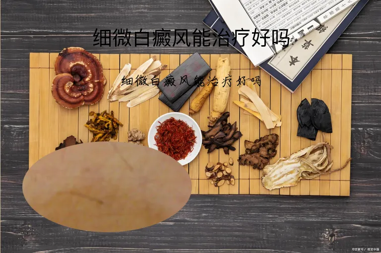 细微白癜风能治疗好吗