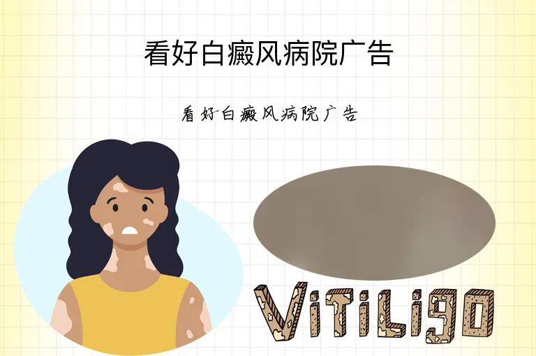 看好白癜风病院广告