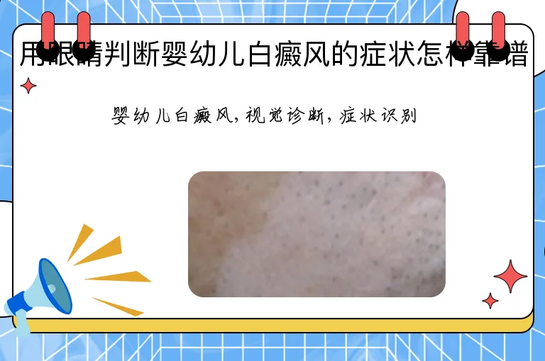 用眼睛判断婴幼儿白癜风的症状怎样靠谱