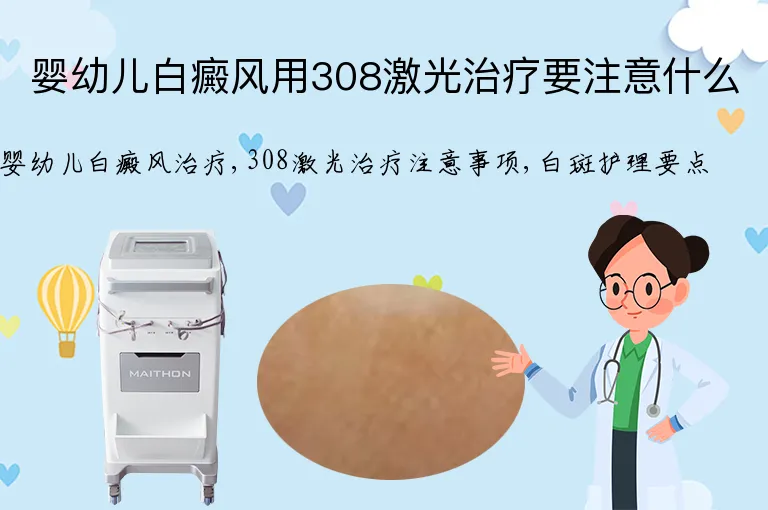 婴幼儿白癜风用308激光治疗要注意什么