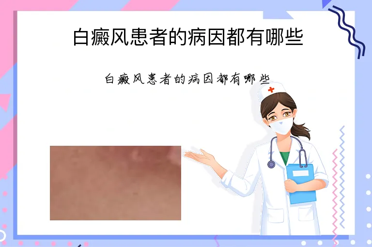 白癜风患者的病因都有哪些