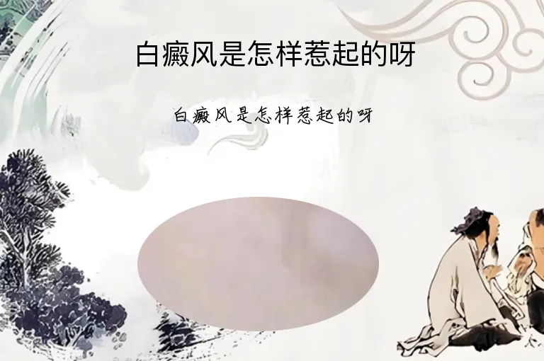 白癜风是怎样惹起的呀