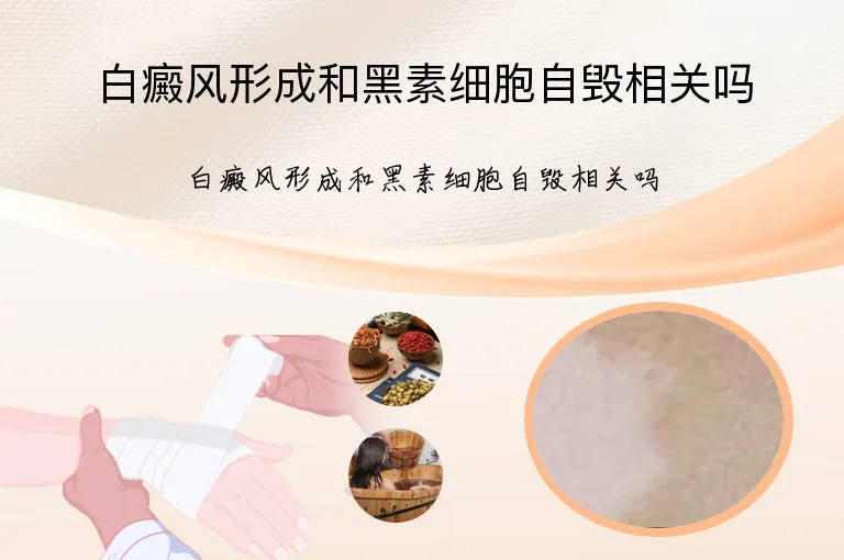 白癜风形成和黑素细胞自毁相关吗