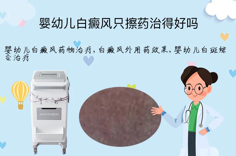 婴幼儿白癜风只擦药治得好吗