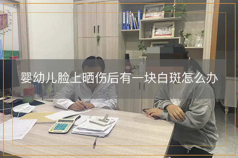 婴幼儿脸上晒伤后有一块白斑怎么办