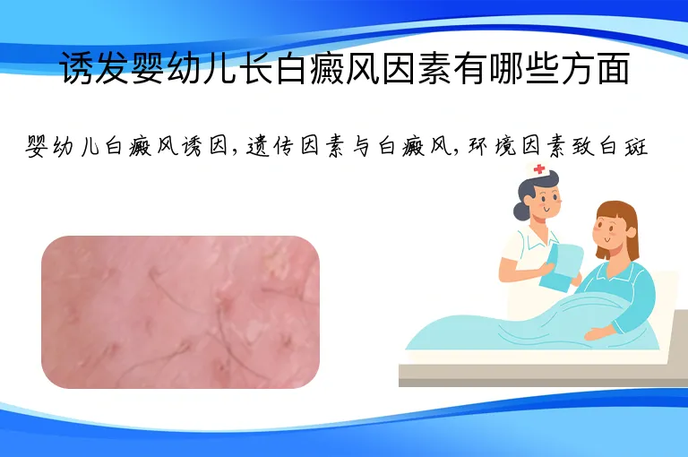 诱发婴幼儿长白癜风因素有哪些方面