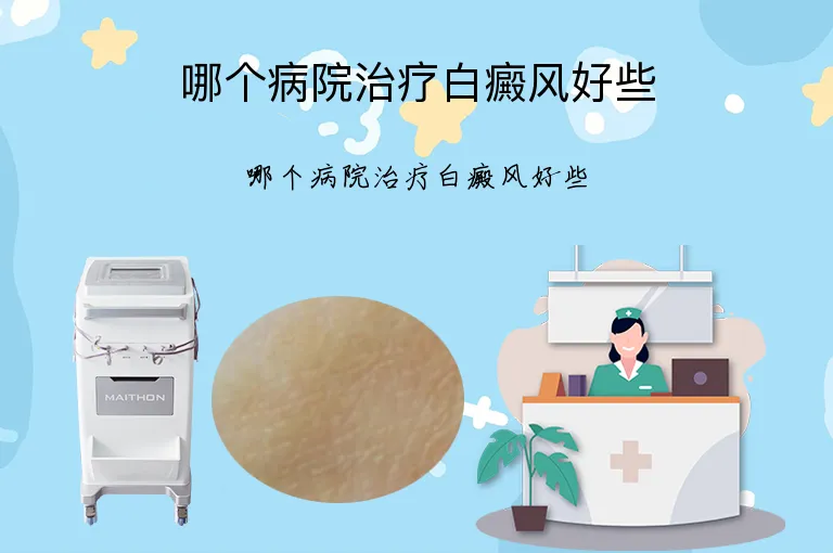 哪个病院治疗白癜风好些