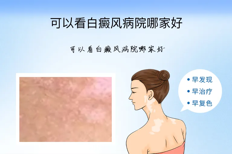 可以看白癜风病院哪家好