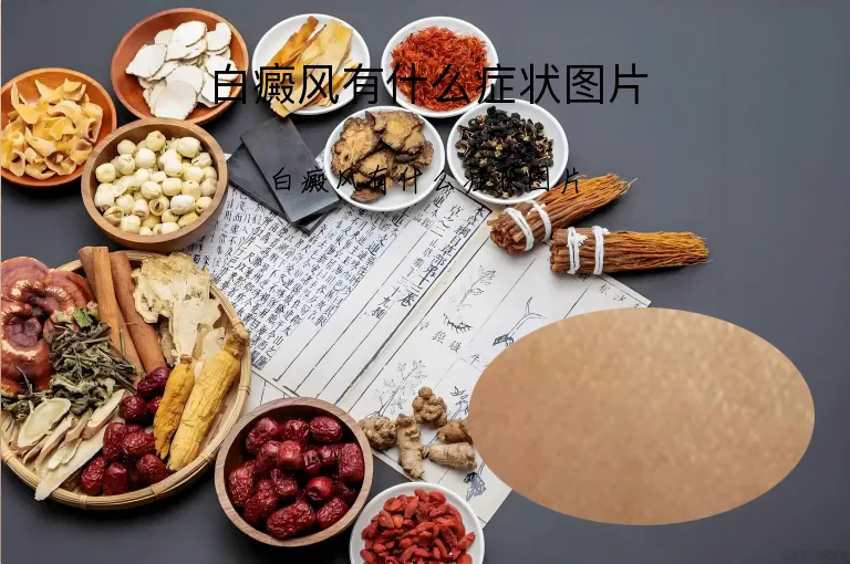 白癜风有什么症状图片