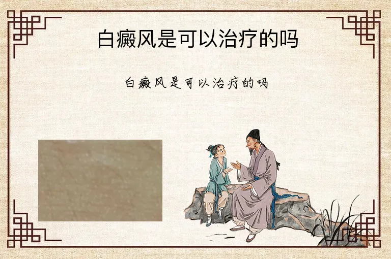 白癜风是可以治疗的吗