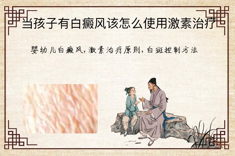 当孩子有白癜风该怎么使用激素治疗