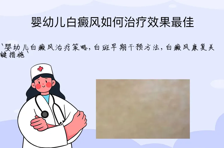 婴幼儿白癜风如何治疗效果最佳