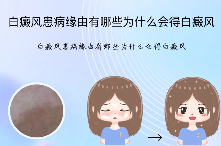 白癜风患病缘由有哪些为什么会得白癜风