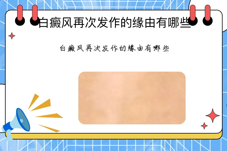 白癜风再次发作的缘由有哪些