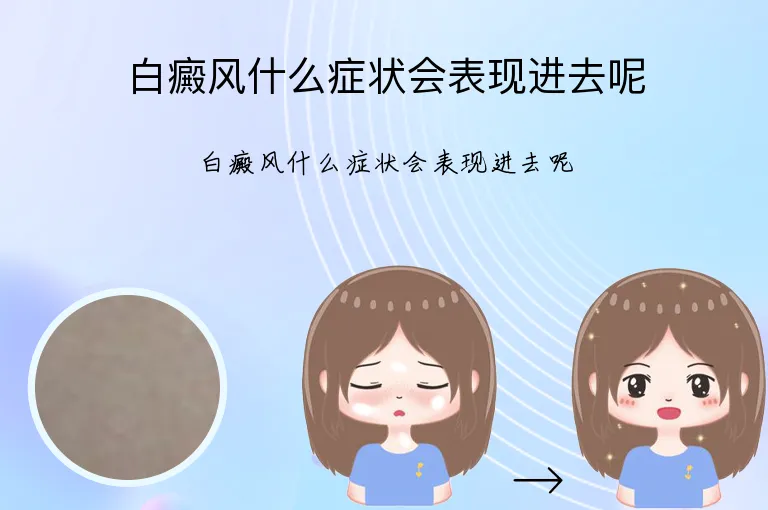 白癜风什么症状会表现进去呢