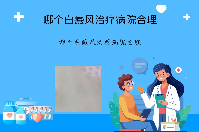 哪个白癜风治疗病院合理
