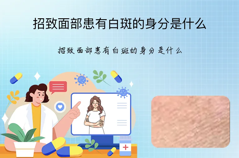 招致面部患有白斑的身分是什么