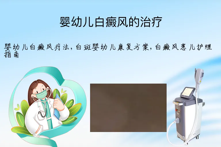 婴幼儿白癜风的治疗