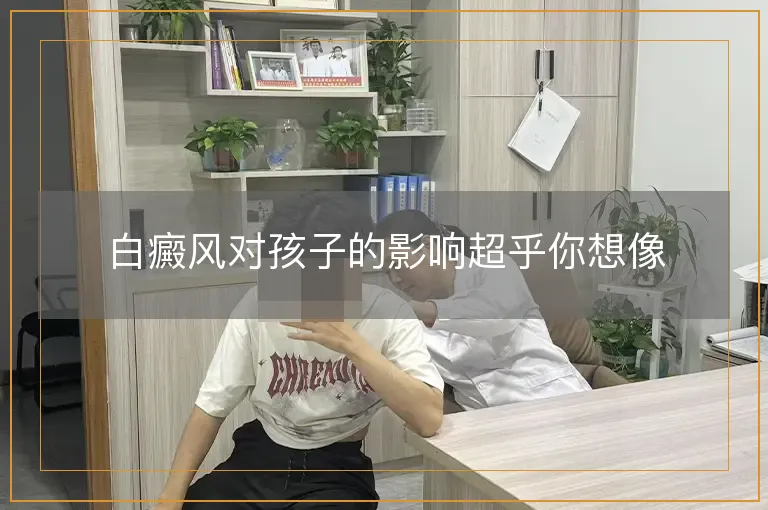 白癜风对孩子的影响超乎你想像
