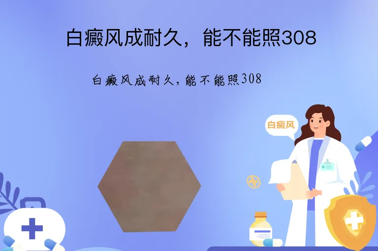 白癜风成耐久，能不能照308