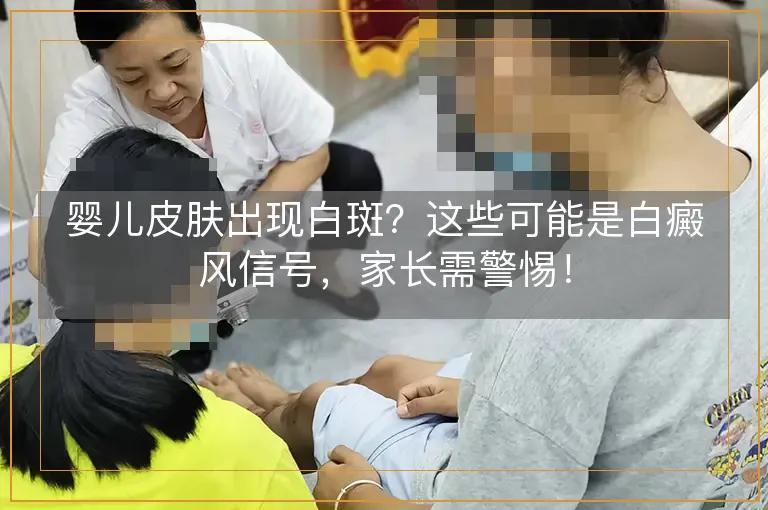 婴儿皮肤出现白斑？这些可能是白癜风信号，家长需警惕！
