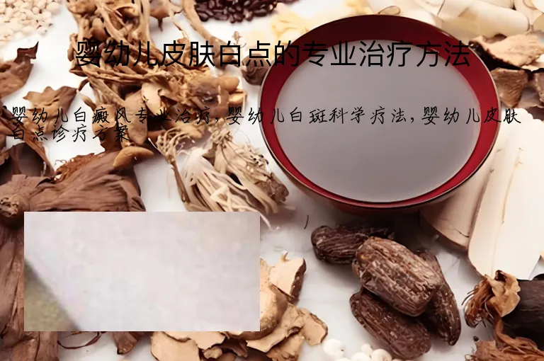 婴幼儿皮肤白点的专业治疗方法