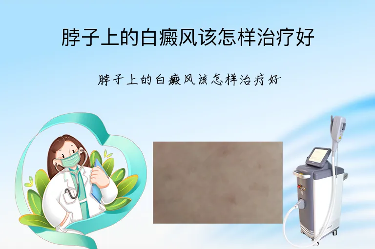 脖子上的白癜风该怎样治疗好