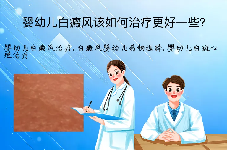婴幼儿白癜风该如何治疗更好一些？