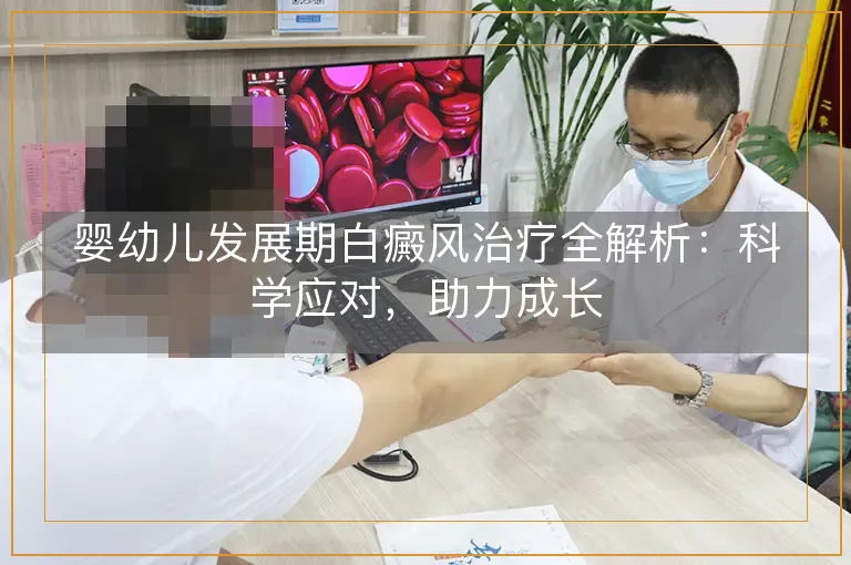 婴幼儿发展期白癜风治疗全解析：科学应对，助力成长