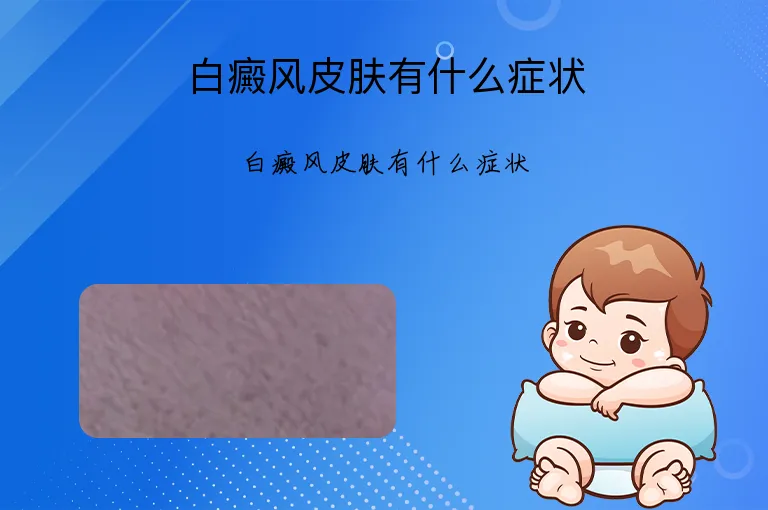 白癜风皮肤有什么症状