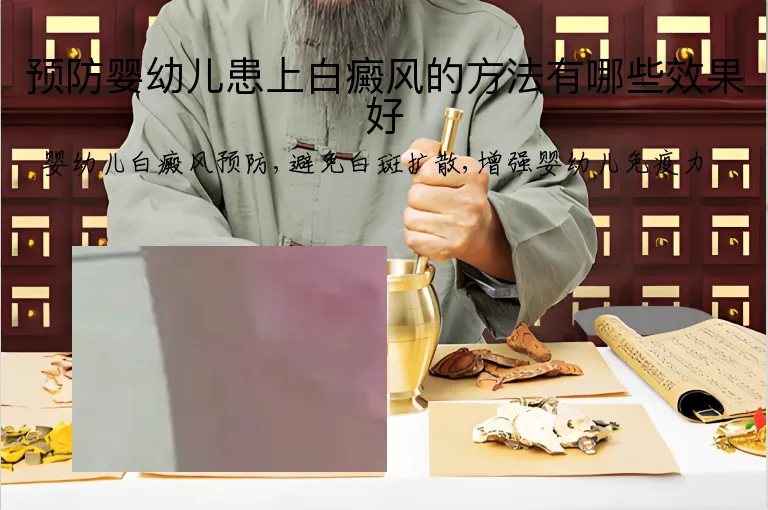 预防婴幼儿患上白癜风的方法有哪些效果好