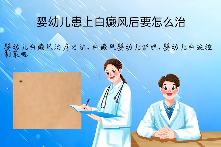 婴幼儿患上白癜风后要怎么治