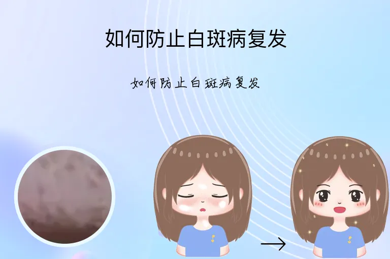 如何防止白斑病复发