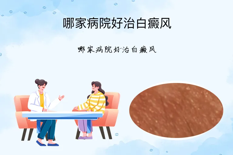 哪家病院好治白癜风