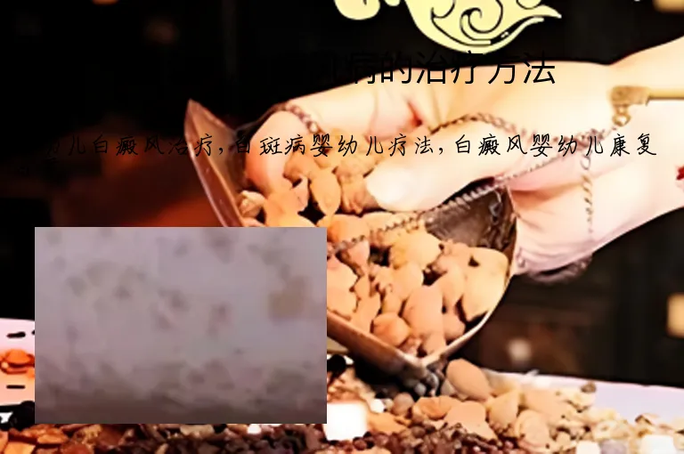 婴幼儿白癜风病的治疗方法
