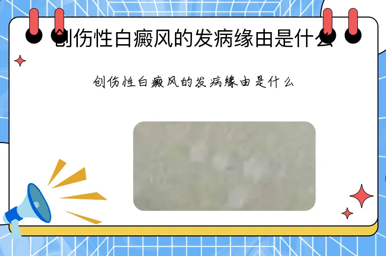 创伤性白癜风的发病缘由是什么