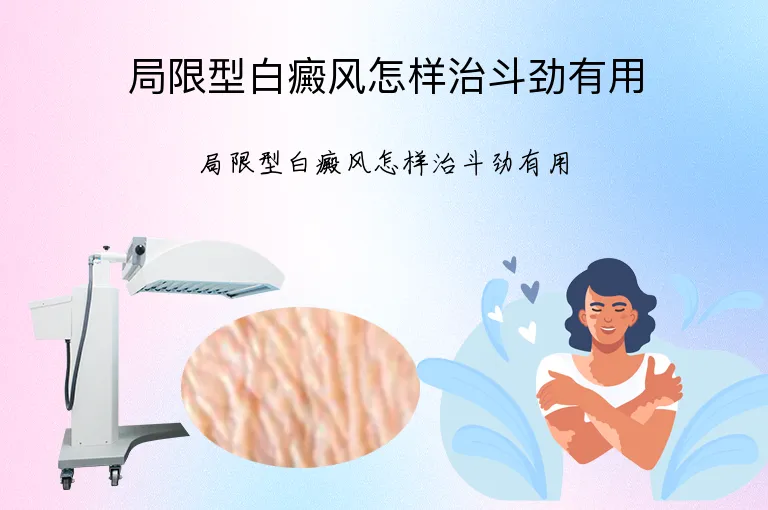 局限型白癜风怎样治斗劲有用