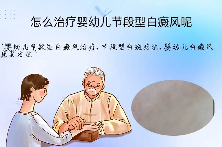 怎么治疗婴幼儿节段型白癜风呢