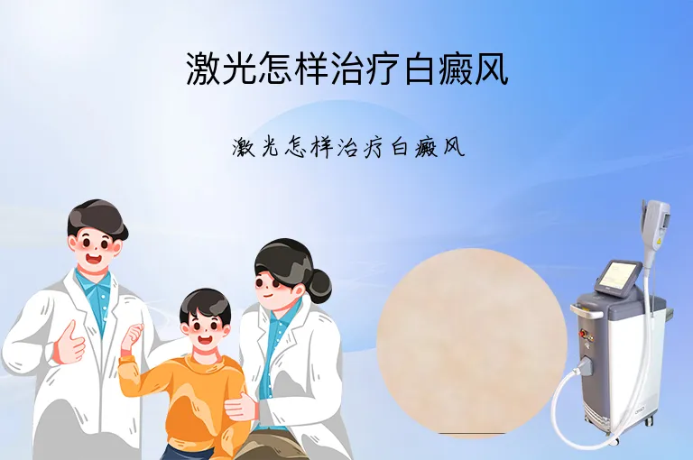 激光怎样治疗白癜风