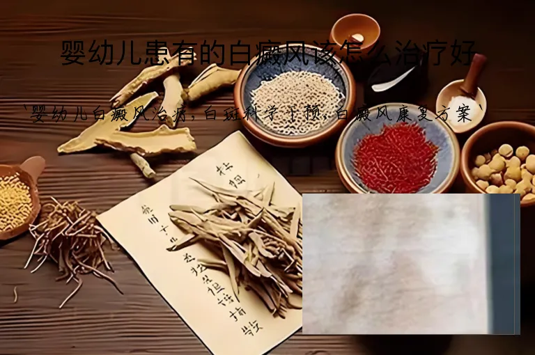婴幼儿患有的白癜风该怎么治疗好