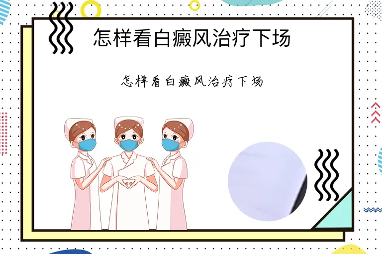 怎样看白癜风治疗下场