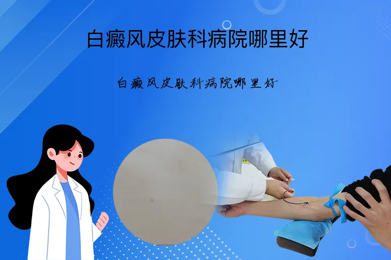白癜风皮肤科病院哪里好