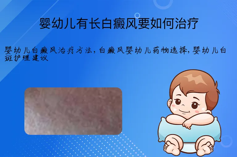 婴幼儿有长白癜风要如何治疗